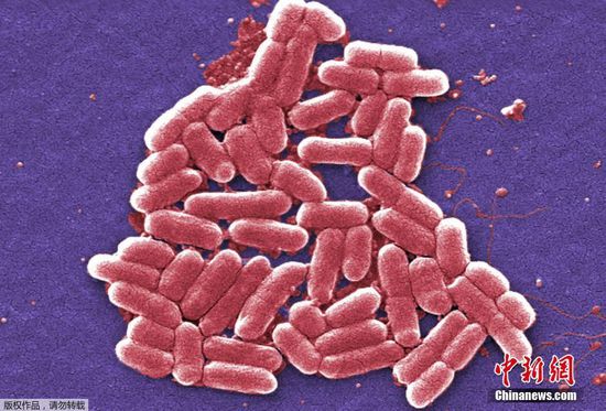 美国现可抵抗所有抗生素的超级病菌